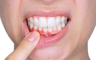 periodoncia